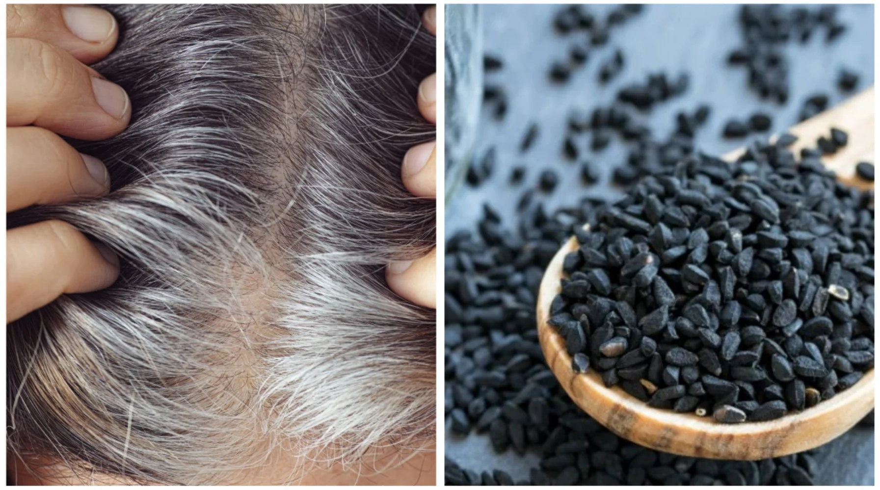 Kalonji for White Hair: सफेद बालों से छुटकारा पाएं: कलौंजी के 3 नेचुरल नुस्खे, बाल होंगे काले और चमकदार