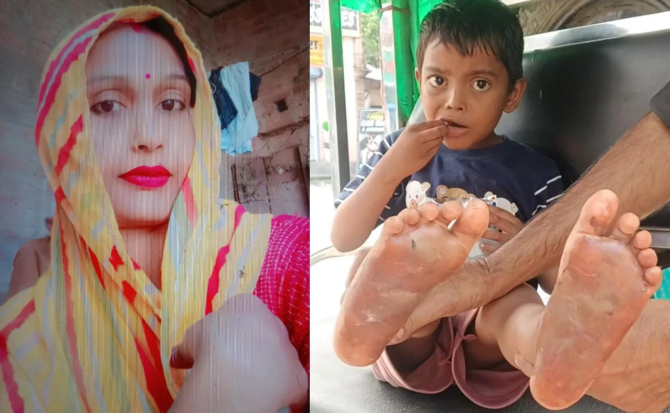उत्तर प्रदेश : मम्मी मत मारो...' 5 रुपये के लिए बेरहम मां ने बच्चे के तलवे गर्म चाकू से दागे, कमरे में बंद कर चली गई पार्टी करने!