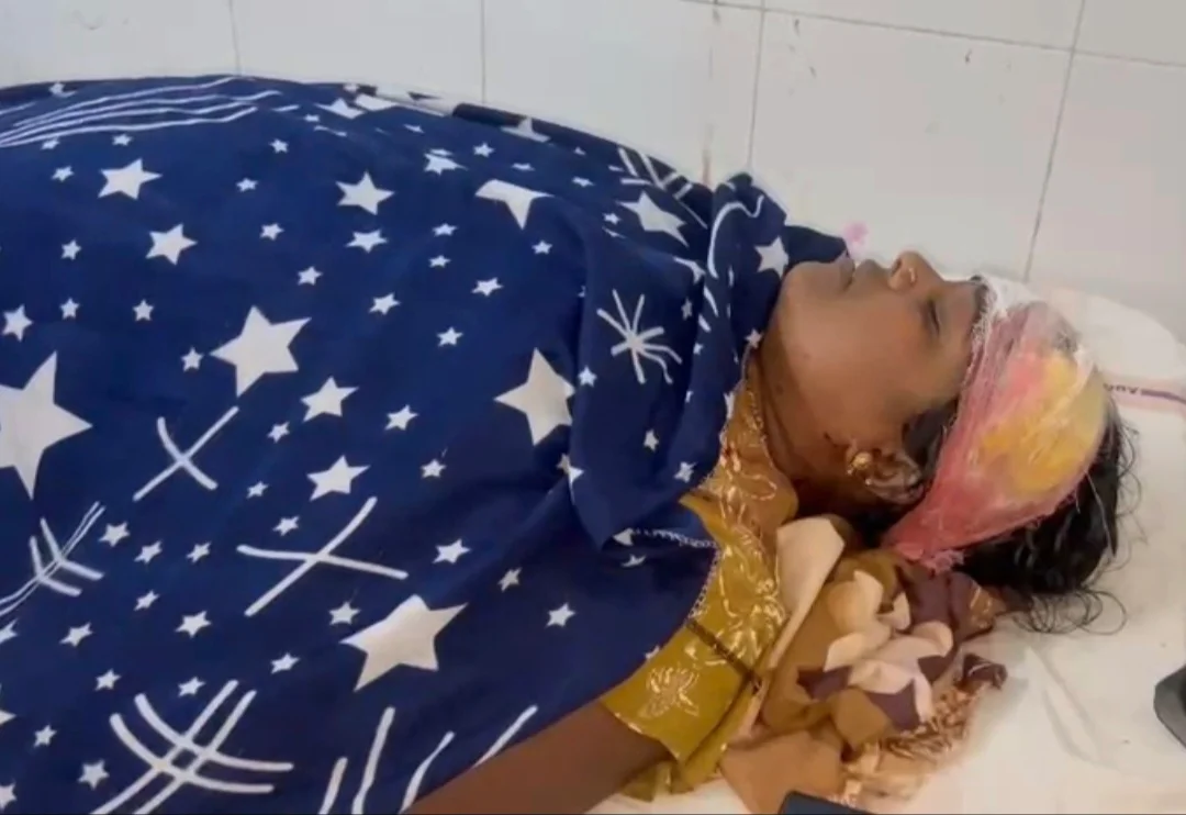 मध्यप्रदेश: मैहर में पति ने पत्नी पर डंडे से किया हमला, सिर में लगे 10 टांके; आरोपी फरार